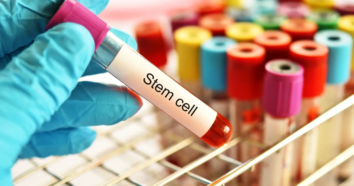 Comparing stem cell IV therapy and PRP regenerative options at iCRYO New Braunfels