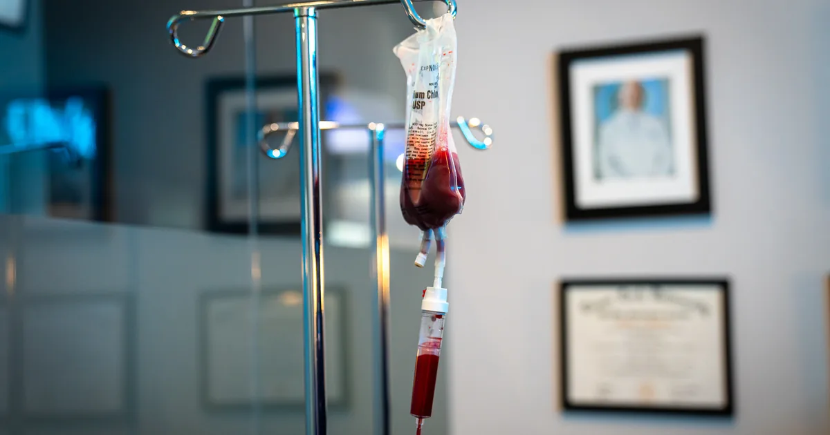 Ozone UV IV compared with a standard vitamin IV drip at iCRYO New Braunfels