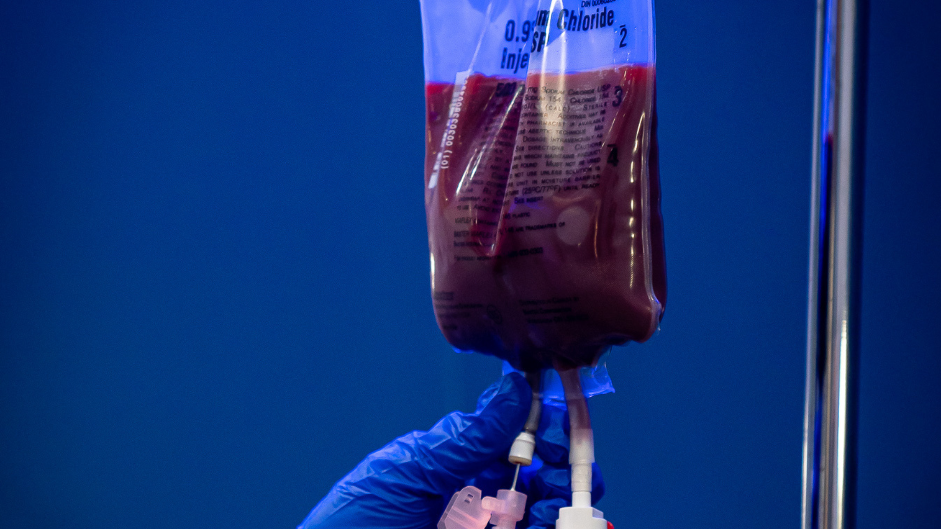 Ozone UV IV therapy treatment setup